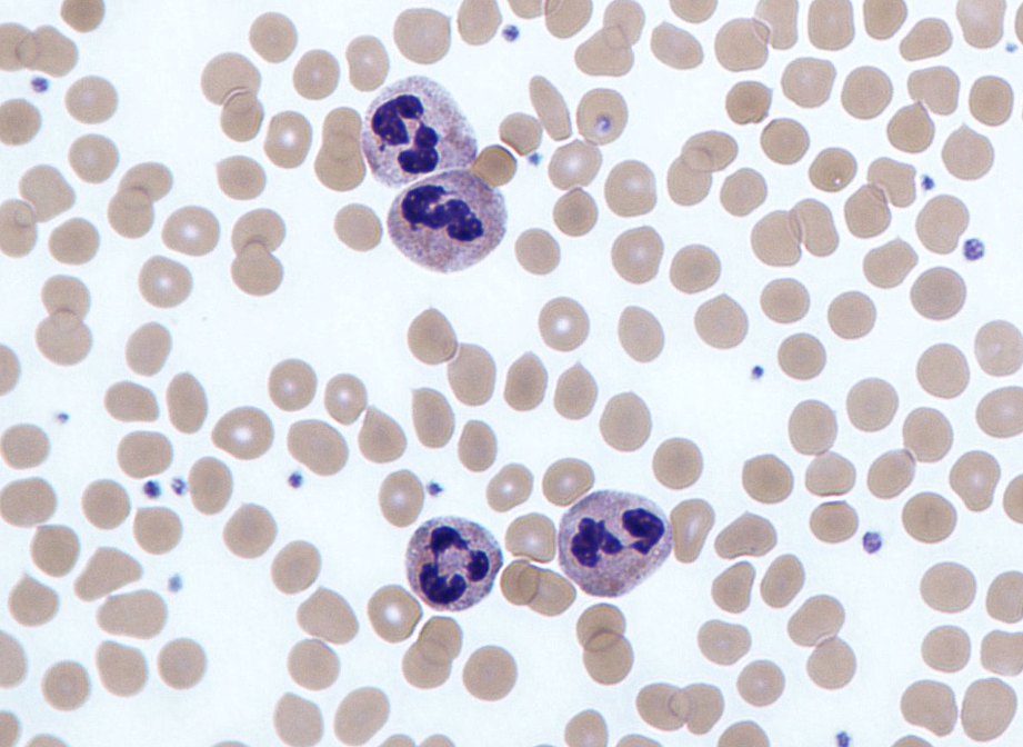 Hình ảnh tế bào bạch cầu hạt trung tính