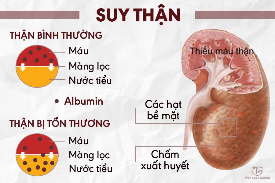 4. Giá Trị Bình Thường Của Chỉ Số Creatinin